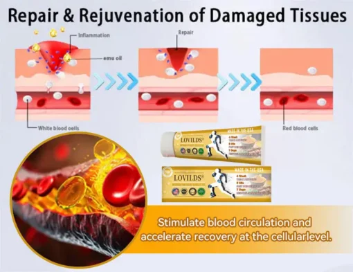 𝐋𝐎𝐕𝐈𝐋𝐃𝐒® 𝐓𝐮𝐫𝐦𝐞𝐫𝐢𝐜 & 𝐄𝐦𝐮 𝐎𝐢𝐥 𝐀𝐫𝐭𝐡𝐫𝐢𝐭𝐢𝐬 𝐒𝐨𝐨𝐭𝐡𝐢𝐧𝐠 𝐏𝐚𝐢𝐧 𝐑𝐞𝐥𝐢𝐞𝐟 𝐌𝐚𝐬𝐬𝐚𝐠𝐞 𝐆𝐞𝐥