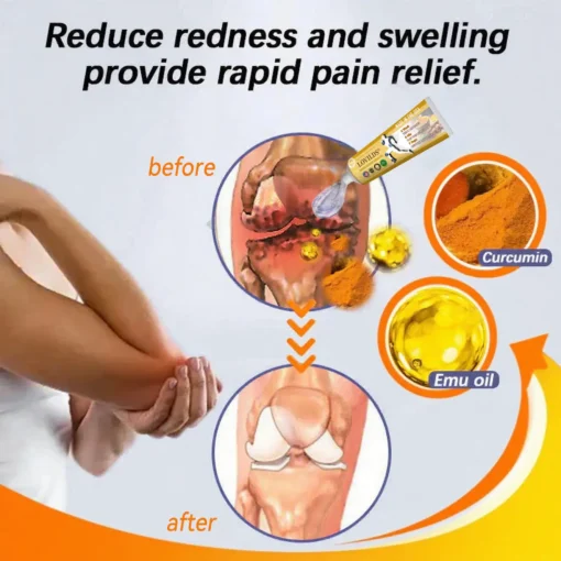 𝐋𝐎𝐕𝐈𝐋𝐃𝐒® 𝐓𝐮𝐫𝐦𝐞𝐫𝐢𝐜 & 𝐄𝐦𝐮 𝐎𝐢𝐥 𝐀𝐫𝐭𝐡𝐫𝐢𝐭𝐢𝐬 𝐒𝐨𝐨𝐭𝐡𝐢𝐧𝐠 𝐏𝐚𝐢𝐧 𝐑𝐞𝐥𝐢𝐞𝐟 𝐌𝐚𝐬𝐬𝐚𝐠𝐞 𝐆𝐞𝐥