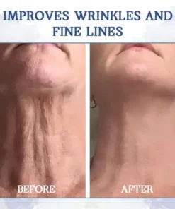 LOVILDS® Advanced Firming & Wrinkle-Reducing Cream