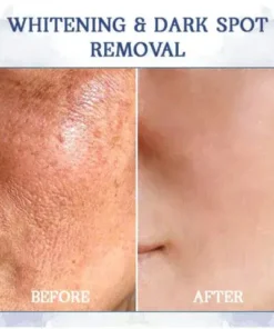 LOVILDS® Advanced Firming & Wrinkle-Reducing Cream