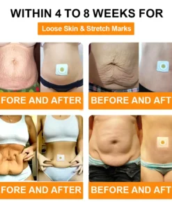 LOVILDS® Bee Lymphatic Drainage Slimming Patch