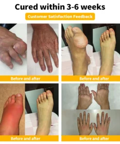 LOVILDS™ Bee Venom Joint Repair Cream