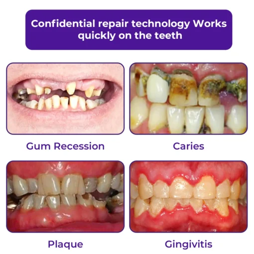 LOVILDS™ Dental Repair Mineral Powder