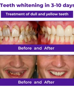 LOVILDS™ Dental Repair Mineral Powder