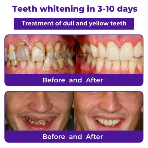 LOVILDS™ Dental Repair Mineral Powder