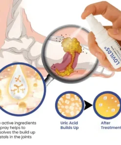 LOVILDS® GoutEase Relief Spray