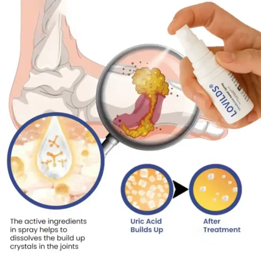 LOVILDS® GoutEase Relief Spray