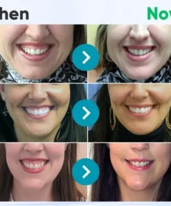 LOVILDS™ Gum Therapy Gel