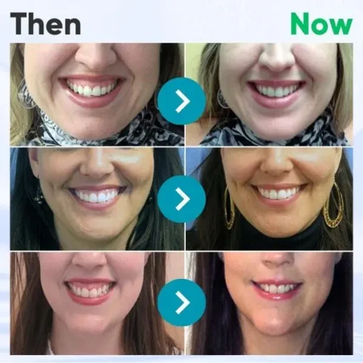 LOVILDS™ Gum Therapy Gel