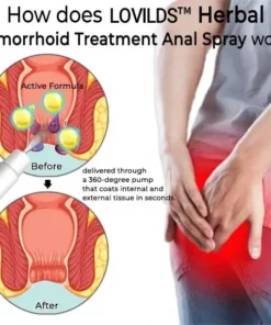 LOVILDS® Herbal Hemorrhoid Treatment Anal Spray Pro