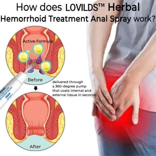 LOVILDS® Herbal Hemorrhoid Treatment Anal Spray Pro