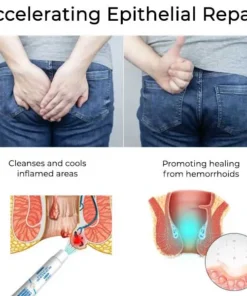 LOVILDS® Herbal Hemorrhoid Treatment Anal Spray Pro