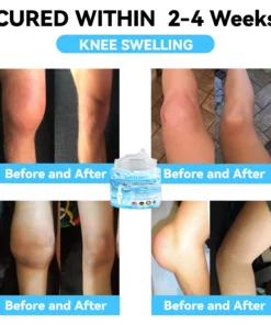 LOVILDS™ Joint & Bone Therapy Cream