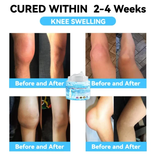 LOVILDS™ Joint & Bone Therapy Cream