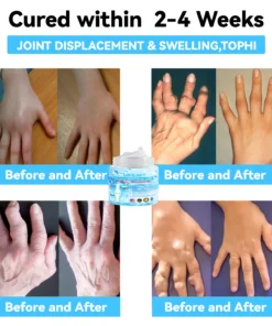 LOVILDS™ Joint & Bone Therapy Cream