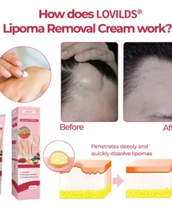 LOVILDS® LumpCure Lipoma Cream