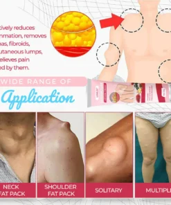 LOVILDS® LumpCure Lipoma Cream