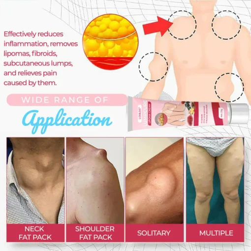 LOVILDS® LumpCure Lipoma Cream