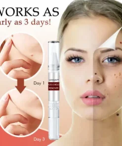 LOVILDS™ Non-Invasive Mole and Wart Removal Pen