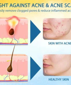 LOVILDS® Psoriasis Care Mellifera Venom Skin Healing Spray