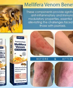 LOVILDS® Psoriasis Care Mellifera Venom Skin Healing Spray