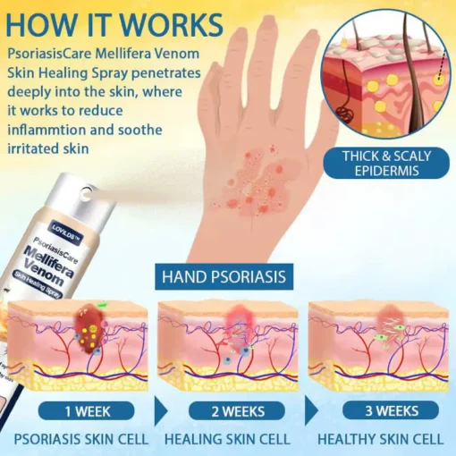 LOVILDS® Psoriasis Care Mellifera Venom Skin Healing Spray