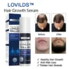 LOVILDS™ Rollerball Serum