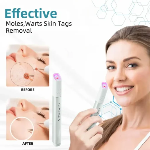 LOVILDS® VelvetSkin+ All-in-One Laser Eraser Pen