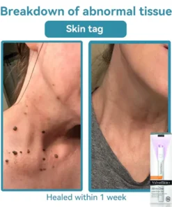 LOVILDS® VelvetSkin+ All-in-One Laser Eraser Pen