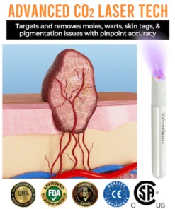 LOVILDS® VelvetSkin+ All-in-One Laser Eraser Pen