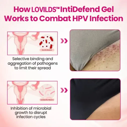 LOVILDS™ interferon gel