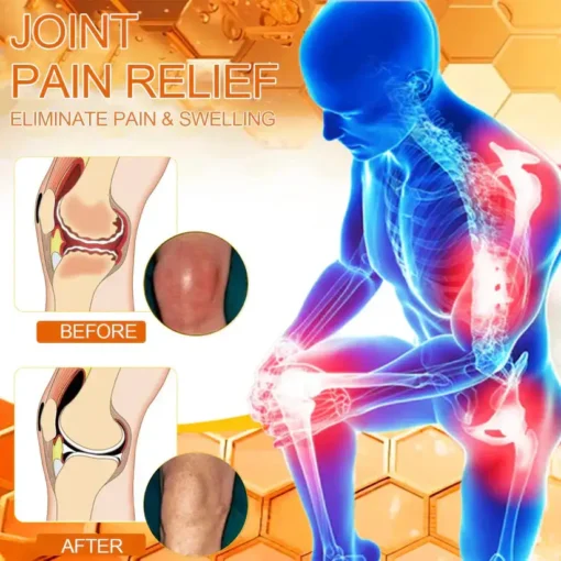 LOVILDS™Bee poison Pain Relief and Bone Care Ointment