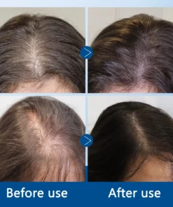 LOVILDS^TM Ice-Roll Hair Activating Serum