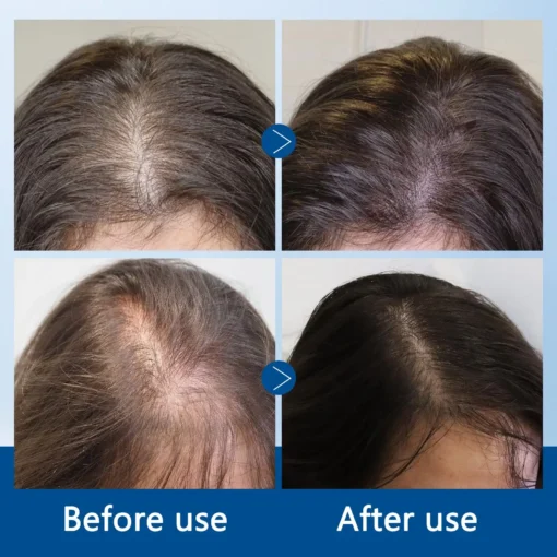 LOVILDS^TM Ice-Roll Hair Activating Serum