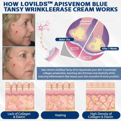 Lovilds™ ApisVenom Blue Tansy WrinkleErase Cream