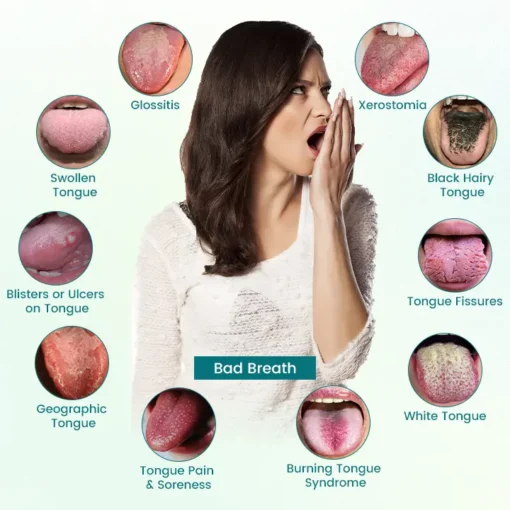 Lovilds® GlosShield Tongue Repair Spray