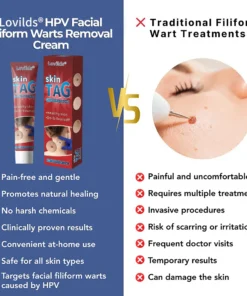 Lovilds® HPV Facial Filiform Warts Removal Cream