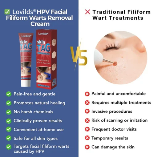 Lovilds® HPV Facial Filiform Warts Removal Cream
