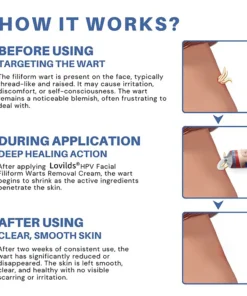 Lovilds® HPV Facial Filiform Warts Removal Cream