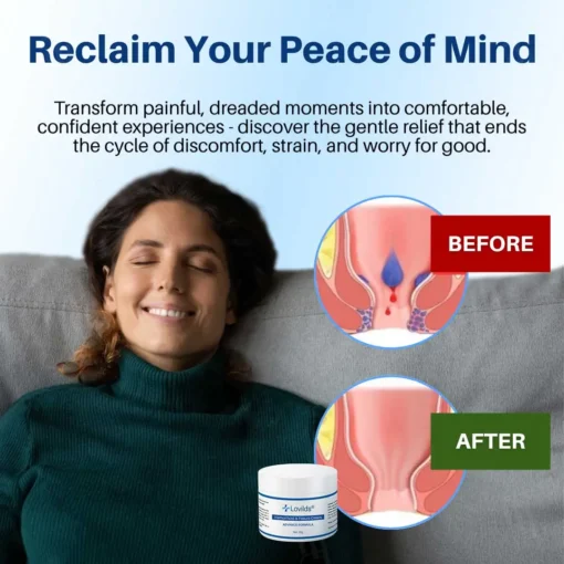 Lovilds® Hemorrhoid & Fissure Cream