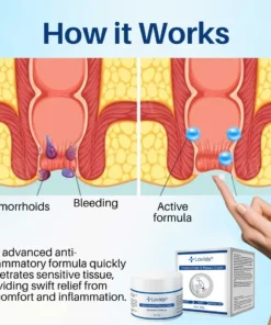 Lovilds® Hemorrhoid & Fissure Cream