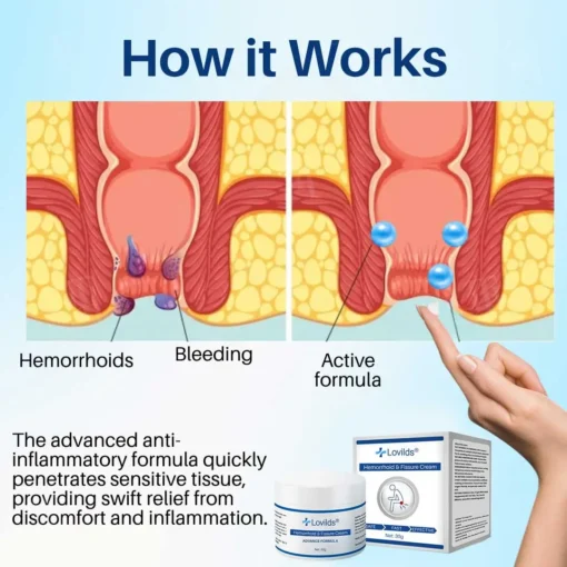 Lovilds® Hemorrhoid & Fissure Cream