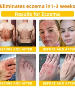 𝑳𝑶𝑽𝑰𝑳𝑫𝑺® 𝘽𝙚𝙚 𝙑𝙚𝙣𝙤𝙢 𝘾𝙤𝙢𝙥𝙧𝙚𝙝𝙚𝙣𝙨𝙞𝙫𝙚 𝘾𝙧𝙚𝙖𝙢