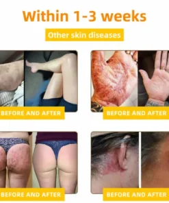 𝑳𝑶𝑽𝑰𝑳𝑫𝑺® 𝘽𝙚𝙚 𝙑𝙚𝙣𝙤𝙢 𝘾𝙤𝙢𝙥𝙧𝙚𝙝𝙚𝙣𝙨𝙞𝙫𝙚 𝘾𝙧𝙚𝙖𝙢