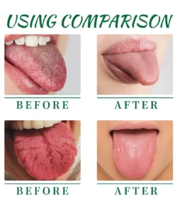 LOVILDS™ 𝙏𝙊𝙉𝙂𝙐𝙀 𝙍𝙀𝙋𝘼𝙄𝙍 𝑺𝒑𝒓𝒂𝒚