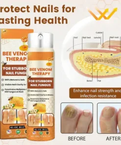 LOVILDS™ Bee Venom Nail Fungus Spray