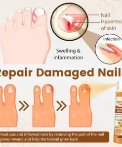 LOVILDS™ Bee Venom Nail Fungus Spray