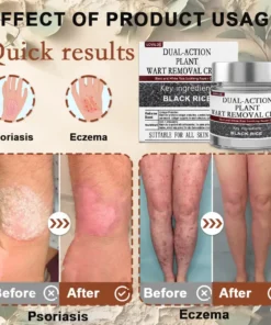 LOVILDS® Black Rice Skin Repair Essence Cream