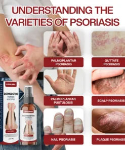 LOVILDS® DermSoothe Psoriasis Relief Spray