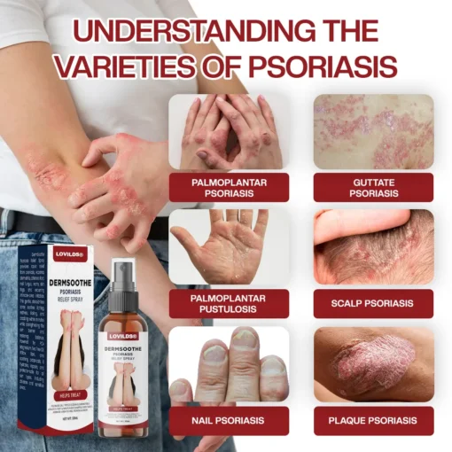 LOVILDS® DermSoothe Psoriasis Relief Spray